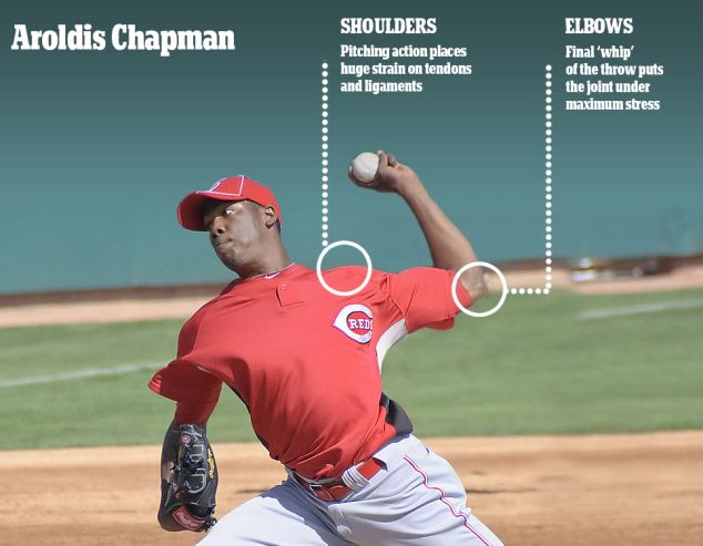 Aroldis Chapman pitching arm care image