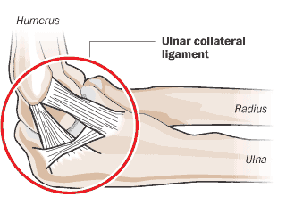 Tommy John elbow image